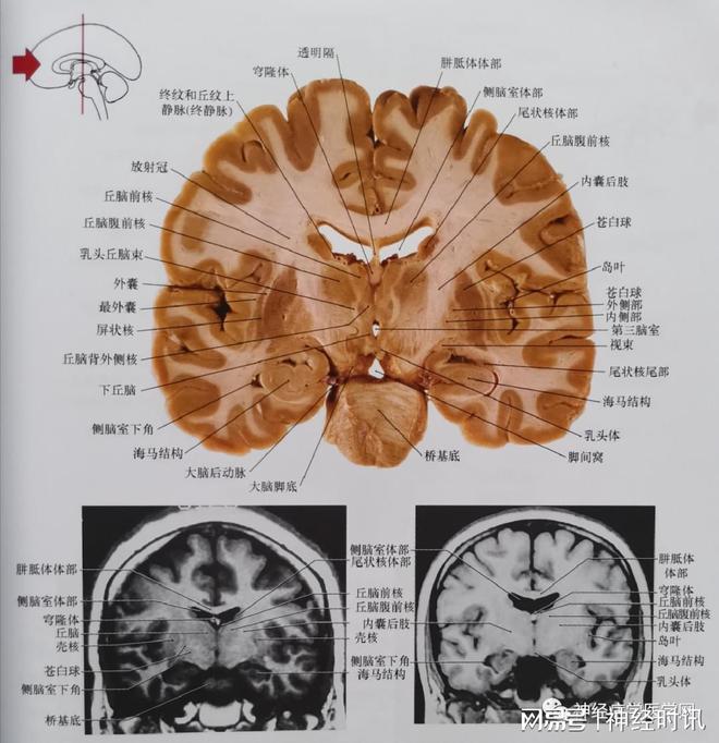 小脑是控制什么的_小脑梗最佳恢复方法_着小脑