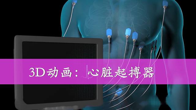 心脏安装起搏器对身体有伤害吗_装心脏起搏器的利与弊_心脏装起搏器好不好